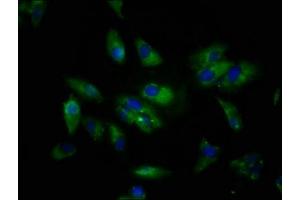 Immunofluorescence staining of Hela cells with ABIN7169553 at 1:133, counter-stained with DAPI. (Sialoadhesin/CD169 anticorps  (AA 572-697))