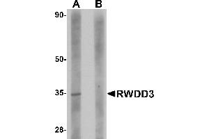 Western blot analysis of RWDD3 in rat kidney tissue lysate with RWDD3 antibody at 1 µg/mL in (A) the absence and (B) the presence of blocking peptide.