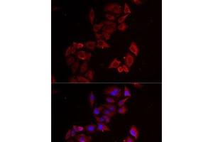 Immunofluorescence analysis of MCF7 cells using LIMS1 Polyclonal Antibody