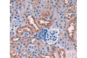 IHC-P analysis of kidney tissue, with DAB staining. (CDK18 anticorps  (AA 121-402))