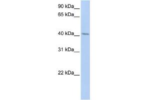 WB Suggested Anti-ERLIN1 Antibody Titration:  0. (ERLIN1 anticorps  (N-Term))