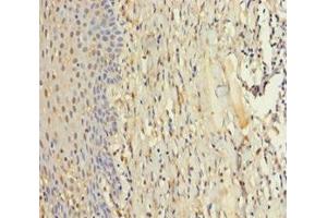 Immunohistochemistry of paraffin-embedded human tonsil tissue using ABIN7176084 at dilution of 1:100 (ZMAT5 anticorps  (AA 1-170))