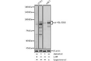 Western blot analysis of extracts of various cell lines, using Phospho-HSL-S563 antibody (ABIN7268278) at 1:1000 dilution.