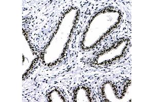 IHC analysis of HP1 gamma using anti-HP1 gamma antibody .