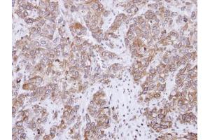 IHC-P Image Immunohistochemical analysis of paraffin-embedded FaDu xenograft, using CD2-associated protein, antibody at 1:500 dilution. (CD2AP anticorps)