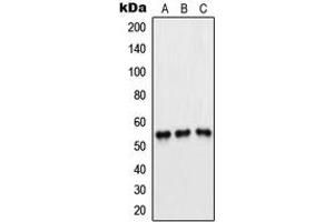 Western blot analysis of PFKFB1/4 expression in Jurkat (A), H1299 (B), HeLa (C) whole cell lysates.