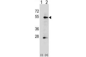 Western blot analysis of ALPP (arrow) using rabbit polyclonal ALPP Antibody (N-term) .