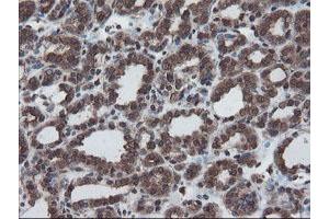 Image no. 11 for anti-SKI-Like Oncogene (SKIL) (AA 307-684) antibody (ABIN1491380)