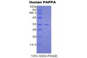 SDS-PAGE (SDS) image for Pregnancy-Associated Plasma Protein A, Pappalysin 1 (PAPPA) (AA 244-501) protein (His tag) (ABIN2121935)