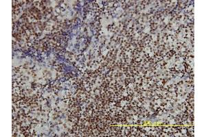 Immunoperoxidase of monoclonal antibody to ANP32A on formalin-fixed paraffin-embedded human tonsil tissue.