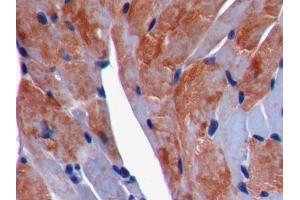 DAB staining on IHC-P; Samples: Mouse Cardiac Muscle Tissue