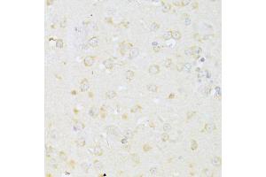 Immunohistochemistry of paraffin-embedded mouse brain using CHRNA7 antibody (ABIN4903285) at dilution of 1:100 (40x lens). (CHRNA7 anticorps)