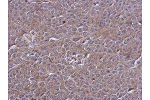 IHC-P Image Immunohistochemical analysis of paraffin-embedded D54 xenograft, using PTPN12, antibody at 1:500 dilution. (PTPN12 anticorps  (N-Term))
