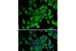 Immunofluorescence analysis of MCF7 cells using PPL Polyclonal Antibody (PPL anticorps)