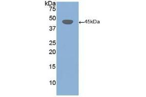 Detection of Recombinant DSG3, Human using Polyclonal Antibody to Desmoglein 3 (DSG3) (Desmoglein 3 anticorps  (AA 858-999))