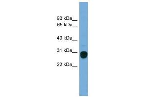 TREM2 antibody used at 1 ug/ml to detect target protein. (TREM2 anticorps  (Middle Region))