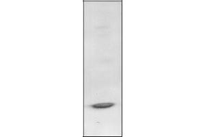 Western Blotting (WB) image for anti-B-Cell CLL/lymphoma 3 (BCL3) antibody (ABIN950631) (BCL3 anticorps)