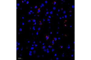 Immunofluorescence of paraffin embedded rat brain using Neurturin (ABIN7074832) at dilution of 1:1000 (400x lens)