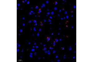 Immunofluorescence of paraffin embedded rat brain using Neurturin (ABIN7074832) at dilution of 1:1000 (400x lens) (Neurturin anticorps)