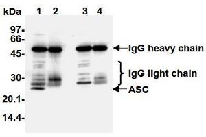 Western Blotting (WB) image for anti-PYD and CARD Domain Containing (PYCARD) antibody (ABIN1105662) (PYCARD anticorps)