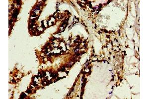 Immunohistochemistry of paraffin-embedded human lung tissue using ABIN7142715 at dilution of 1:100