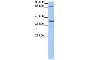 NLGN4X antibody used at 1 ug/ml to detect target protein. (Neuroligin 4 anticorps  (N-Term))