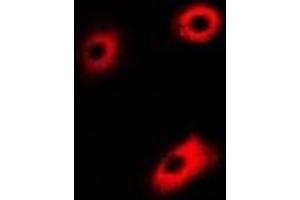 Immunofluorescent analysis of DLD staining in U2OS cells. (DLD anticorps)