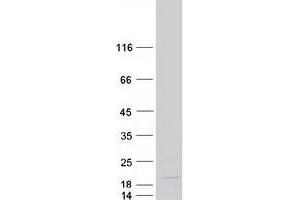 Validation with Western Blot