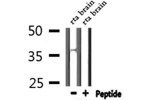 Western blot analysis of extracts from Rat brain, using AWAT1 Antibody. (AWAT1 anticorps  (Internal Region))