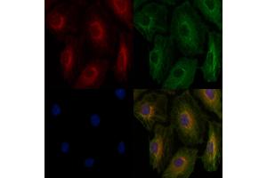 ABIN6262382 and ABIN6276902 staining  cells by IF/ICC.