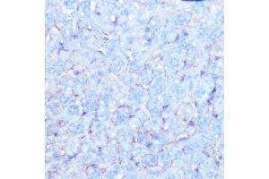 Immunohistochemistry of paraffin-embedded mouse liver using Na+/K+-ATPase Rabbit mAb (ABIN7270390) at dilution of 1:100 (40x lens). (ATP1A1 anticorps)
