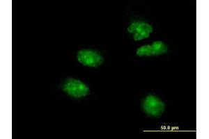 Immunofluorescence of monoclonal antibody to FOXA2 on HeLa cell. (FOXA2 anticorps  (AA 363-457))