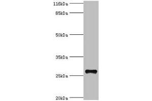 Western blot All lanes: TSPAN6 antibody at 20 μg/mL + Mouse liver tissue Secondary Goat polyclonal to rabbit IgG at 1/10000 dilution Predicted band size: 28 kDa Observed band size: 28 kDa (Tetraspanin 6 anticorps  (AA 115-208))