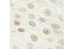 Immunohistochemistry (IHC) image for anti-DEAH (Asp-Glu-Ala-His) Box Polypeptide 33 (DHX33) (AA 1-50) antibody (ABIN7448528)