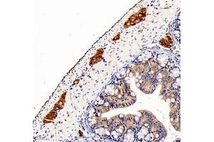 Immunohistochemistry analysis of paraffin embedded mouse colon using peripherin (ABIN7075012) at dilution of 1: 1600