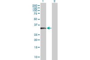 Western Blot analysis of BCL11A expression in transfected 293T cell line by BCL11A MaxPab polyclonal antibody. (BCL11A anticorps  (AA 1-243))