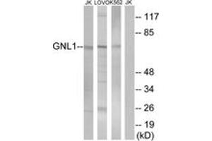 Western blot analysis of extracts from Jurkat/LOVO/K562 cells, using GNL1 Antibody.