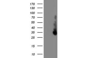 Western Blotting (WB) image for anti-Excision Repair Cross Complementing Polypeptide-1 (ERCC1) antibody (ABIN1498065) (ERCC1 anticorps)