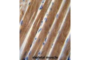 TNIP1 antibody (C-term) immunohistochemistry analysis in formalin fixed and paraffin embedded human skeletal muscle followed by peroxidase conjugation of the secondary antibody and DAB staining.