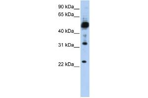WB Suggested Anti-TMEM38B Antibody Titration:  0. (TMEM38B anticorps  (C-Term))