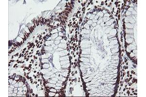Image no. 15 for anti-Fragile X Mental Retardation 1 (FMR1) (AA 36-279) antibody (ABIN1491454)