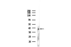 anti-Melatonin Receptor 1B (MTNR1B) (N-Term) antibody