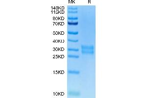 Biotinylated Human M-CSF on Tris-Bis PAGE under reduced condition. (M-CSF/CSF1 Protein (AA 33-190) (His-Avi Tag,Biotin))