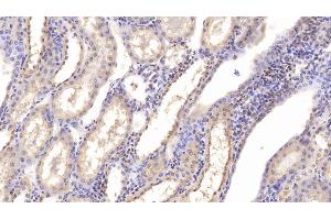 Detection of CHEM in Human Kidney Tissue using Monoclonal Antibody to Chemerin (CHEM) (Chemerin anticorps  (AA 33-158))