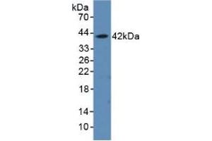Western blot analysis of recombinant Rat aHSP. (aHSP anticorps  (AA 2-102))