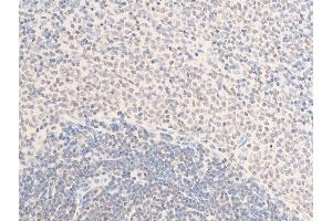 ABIN6267285 at 1/100 staining rat spleen tissue sections by IHC-P.
