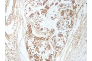 IHC analysis of formalin-fixed paraffin-embedded fetal bronchus, using SUN1 antibody (1/100 dilution).