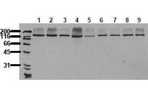 Western Blotting (WB) image for anti-RAPTOR (RAPTOR) antibody (ABIN492625) (RAPTOR anticorps)