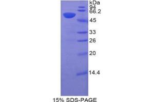 SDS-PAGE analysis of Pig HIF1a Protein.