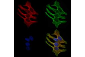 ABIN6259004 and ABIN6276119 staining Hela cells by IF/ICC.